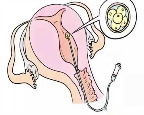 解析成都代怀孕的潜在风险与生育新选择